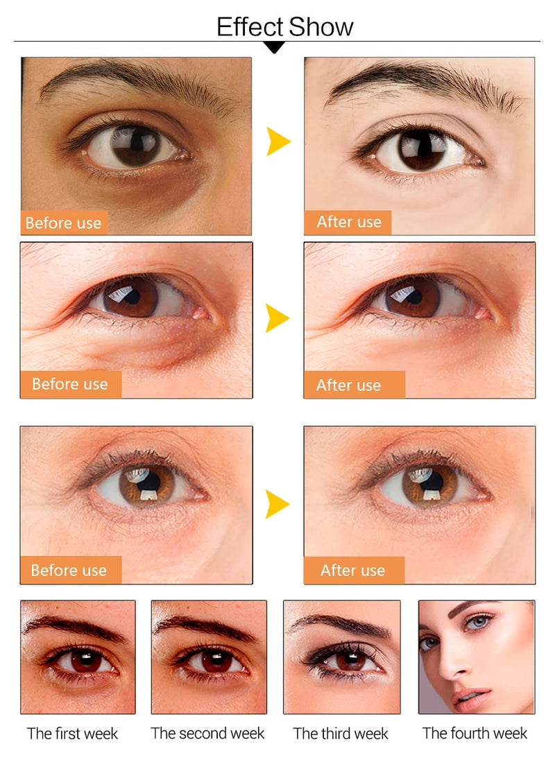 10 piezas de máscara de ojos de colágeno de cristal dorado en polvo, antienvejecimiento, ojeras, acné, parches de belleza para el cuidado de la piel de los ojos, cosméticos coreanos